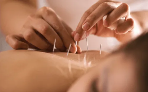Acupuncture at Herbs Song